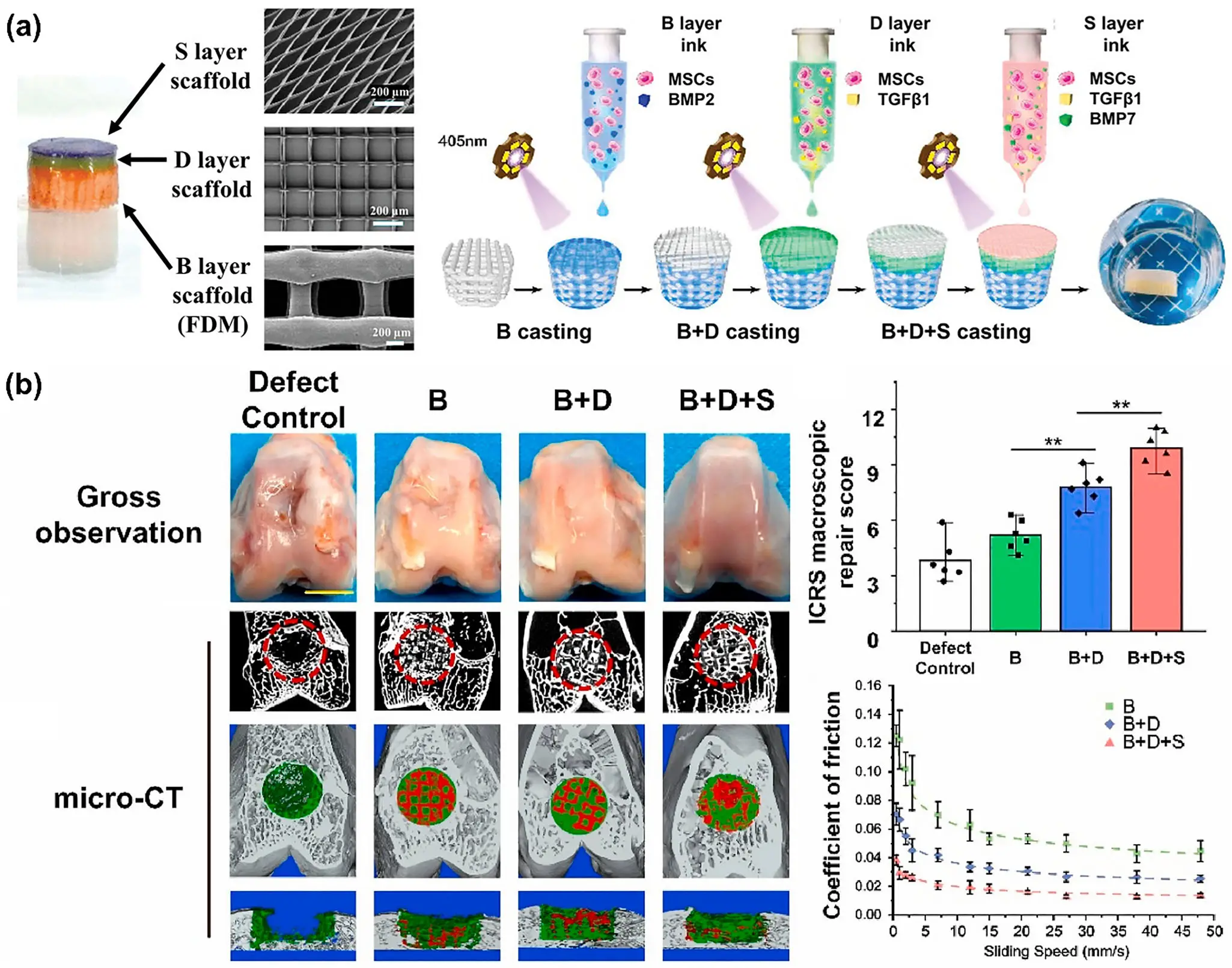 图13:骨-软骨三层复合修复