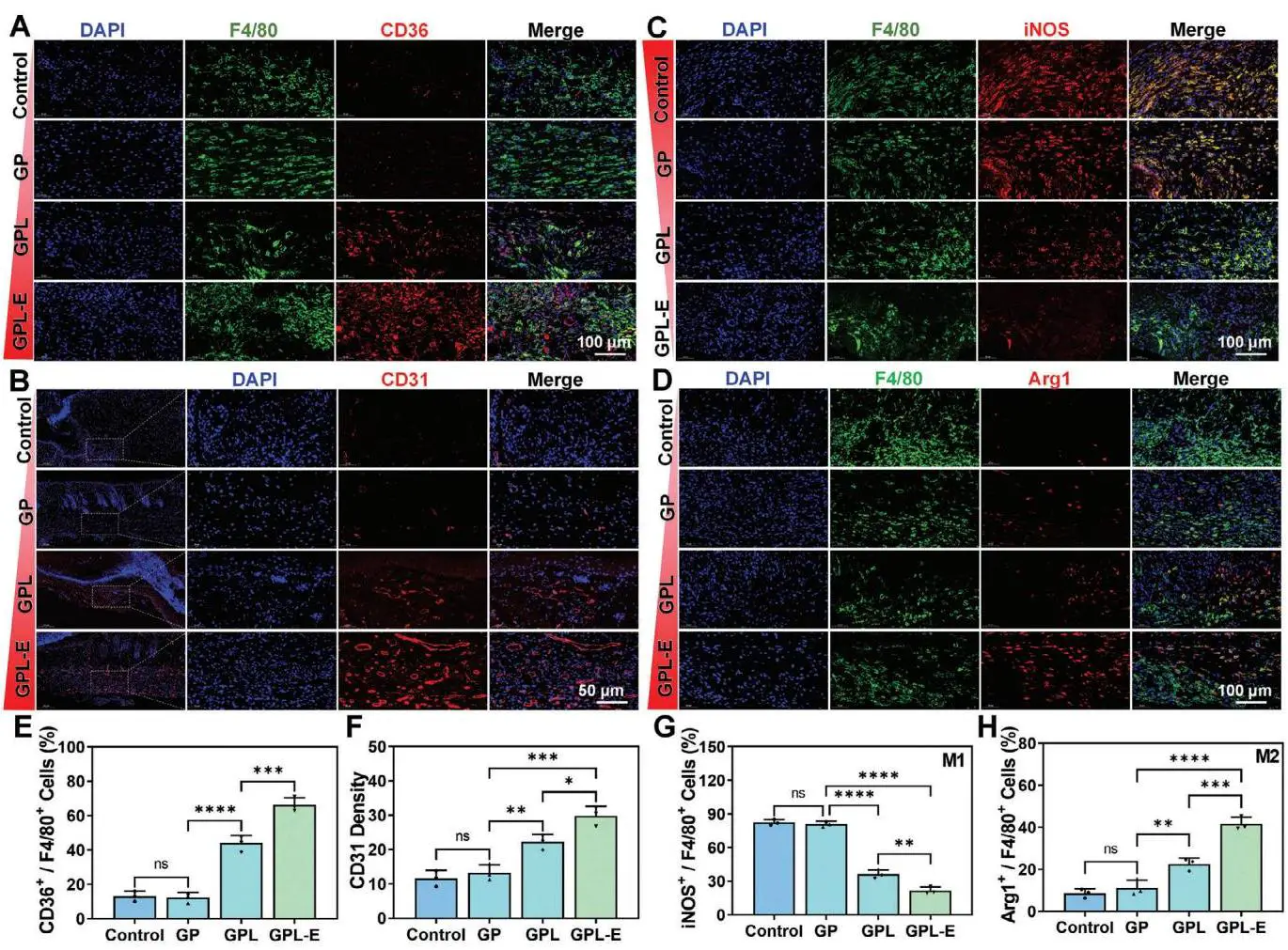 Adv Funct Materials - 2024 - Li - Grid Efferocytosis via Near‐Field Electrostat_12